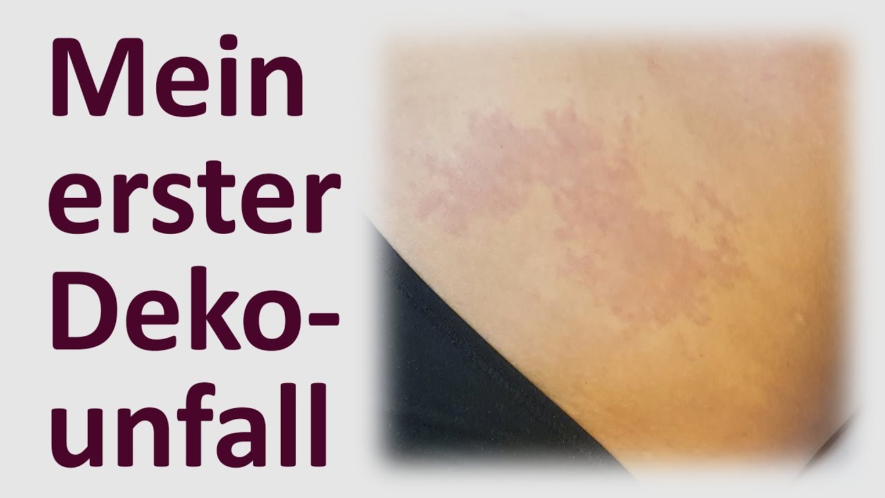 Mein erster Dekounfall