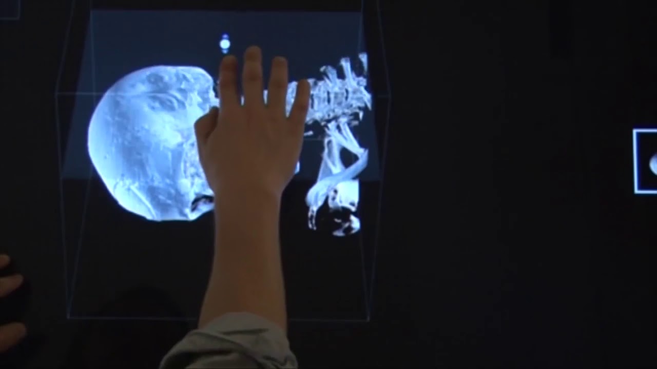 VID 006 Virtual autopsy