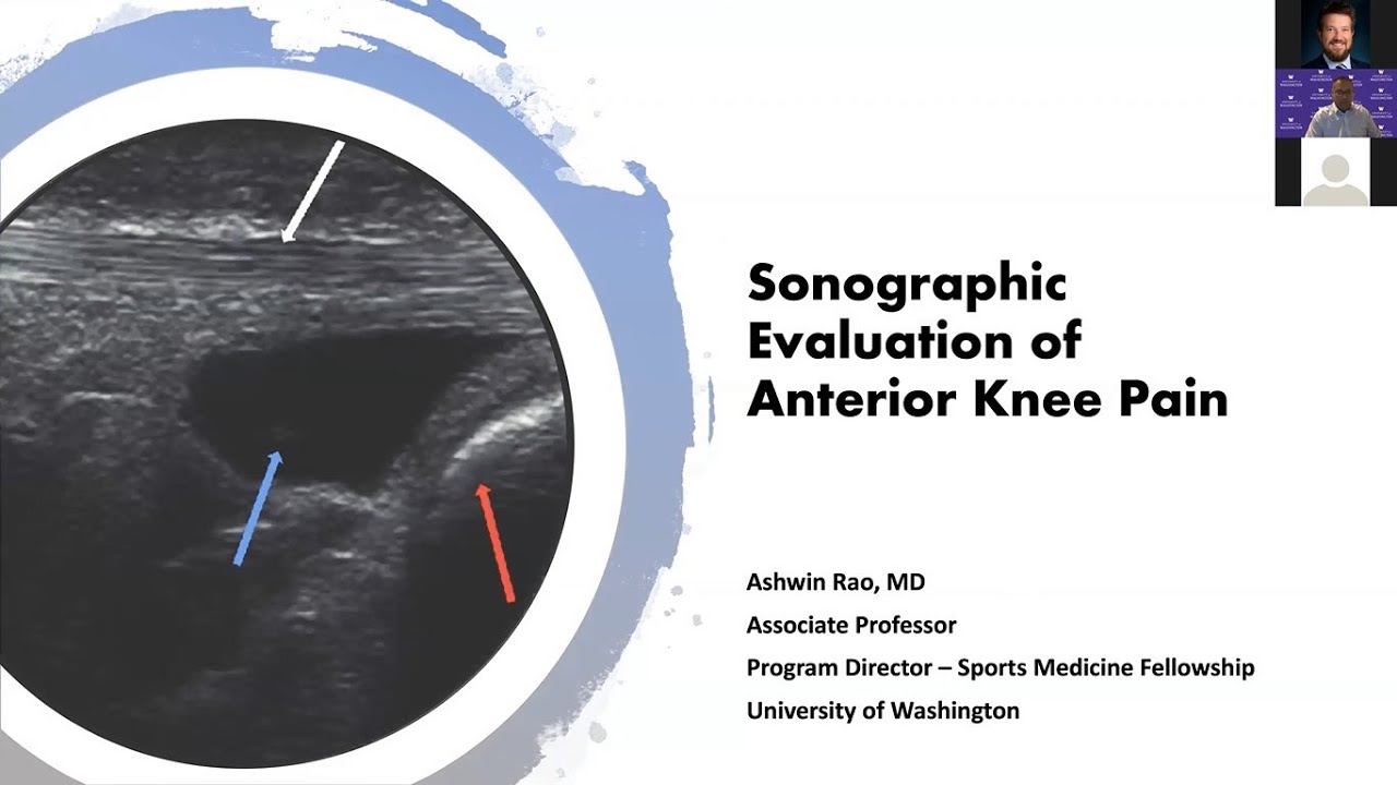 Anterior Knee with Dr. Ashwin Rao | AMSSM Sports Ultrasound Case Presentation