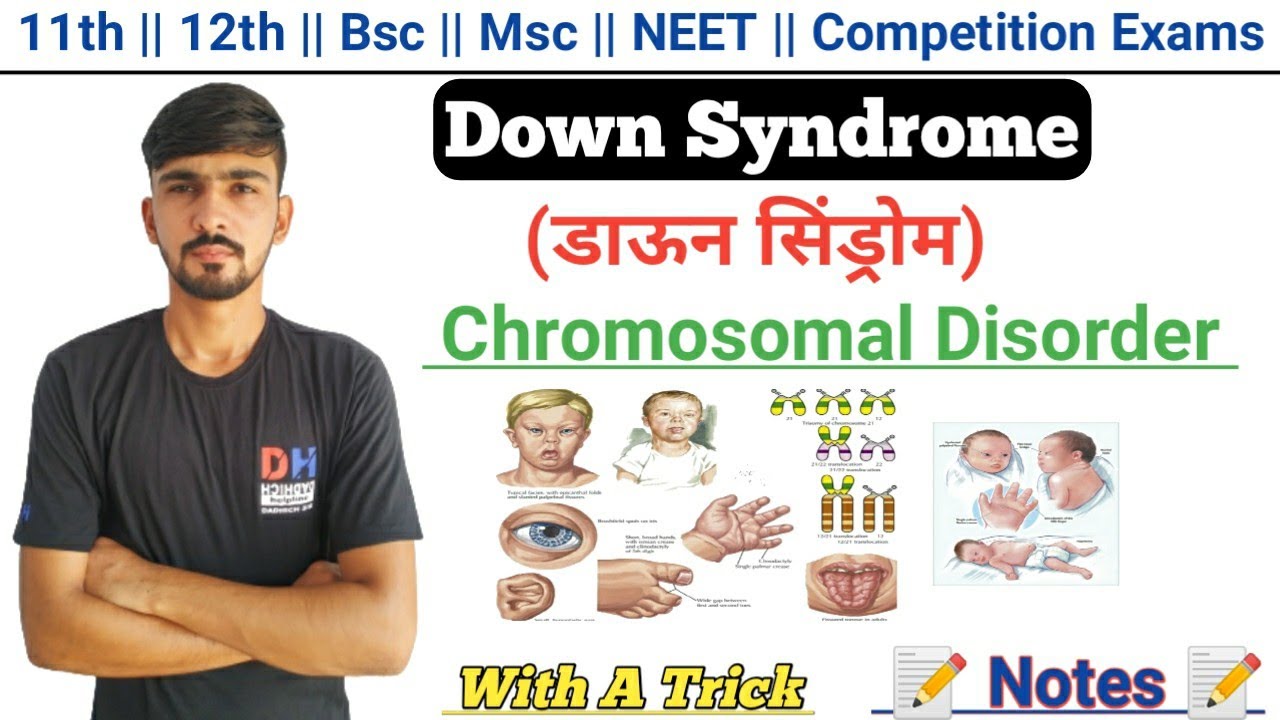Down's Syndrome In Hindi || Chromosomal Disorder || Genetics || By Dadhich Sir