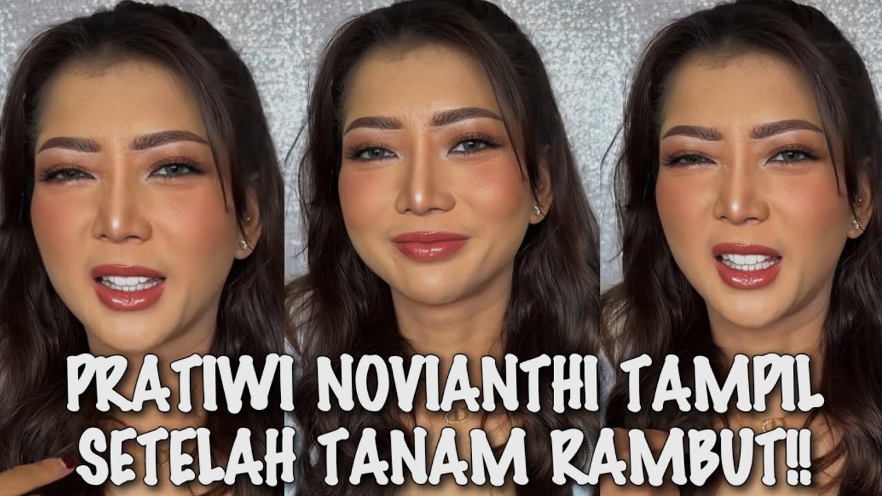 VIRAL•√ TAMPILAN TERBARU PRATIWI NOVIANTHI SETELAH TANAM RAMBUT!!