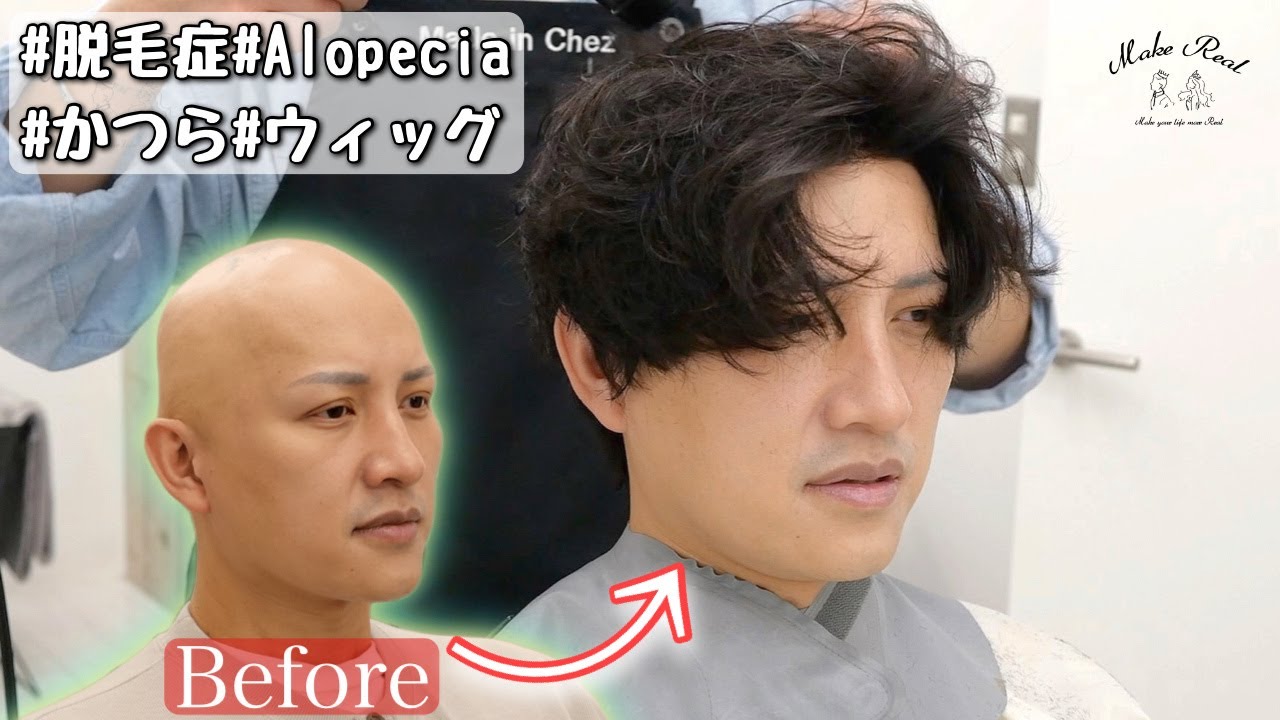 脱毛症になった売れっ子モデルの彼がウィッグで大変身。