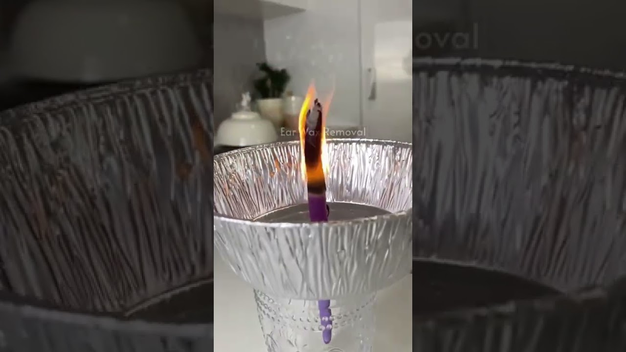 Does ear candling actually work??? | PART 1 | Ear wax removal (Ear cleaning)