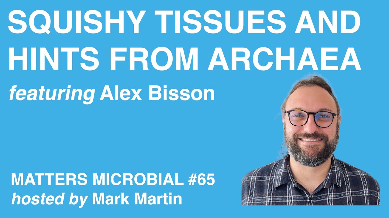 Matters Microbial #65: Squishy Tissues and Hints from Archaea