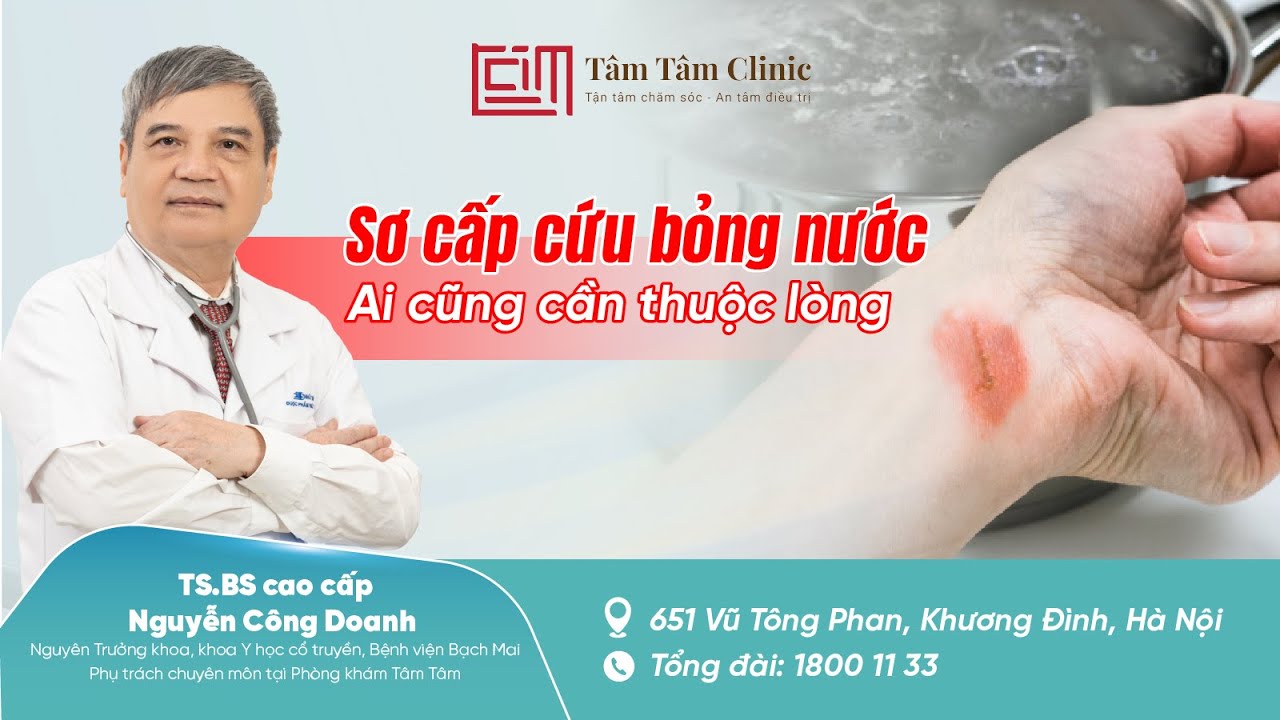 Sơ cấp cứu bỏng nước: Biết sớm - Tránh biến chứng nặng