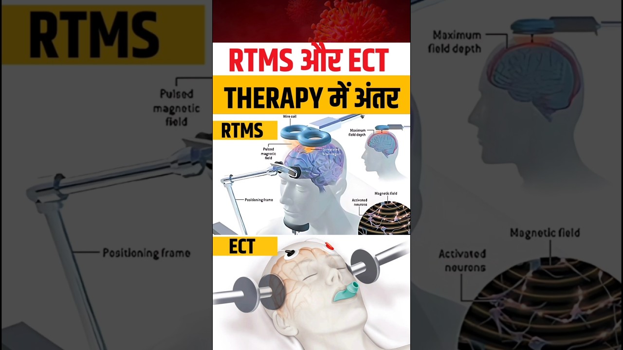 RTMS Therapy Aur ECT Mein Kya Difference Hai? Shock Therapy Ka Sach! | Mental Disorder Treatment