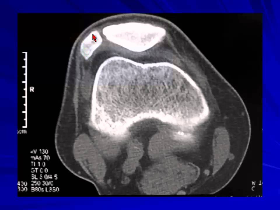 17 CT Anatomy of knees