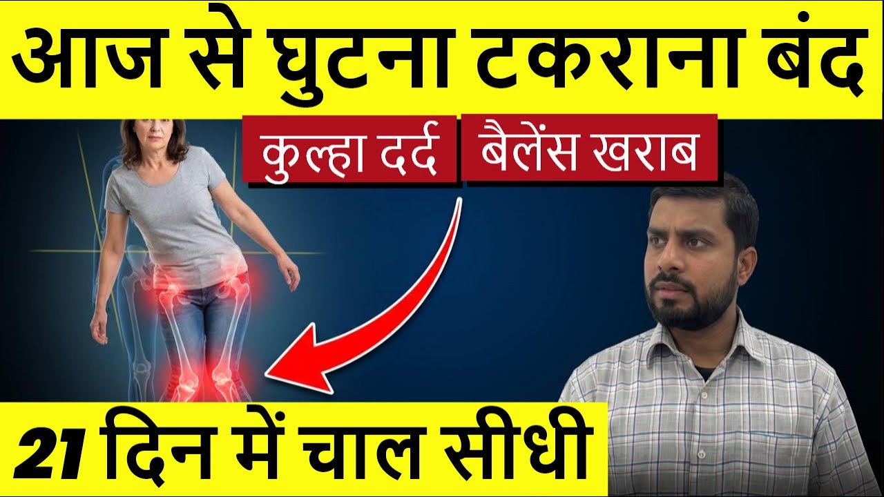 घिसे हुए टेढ़े घुटने(Knock Knee) सीधे करें सर्जरी से बचें|Knock Knee Correction Exercises