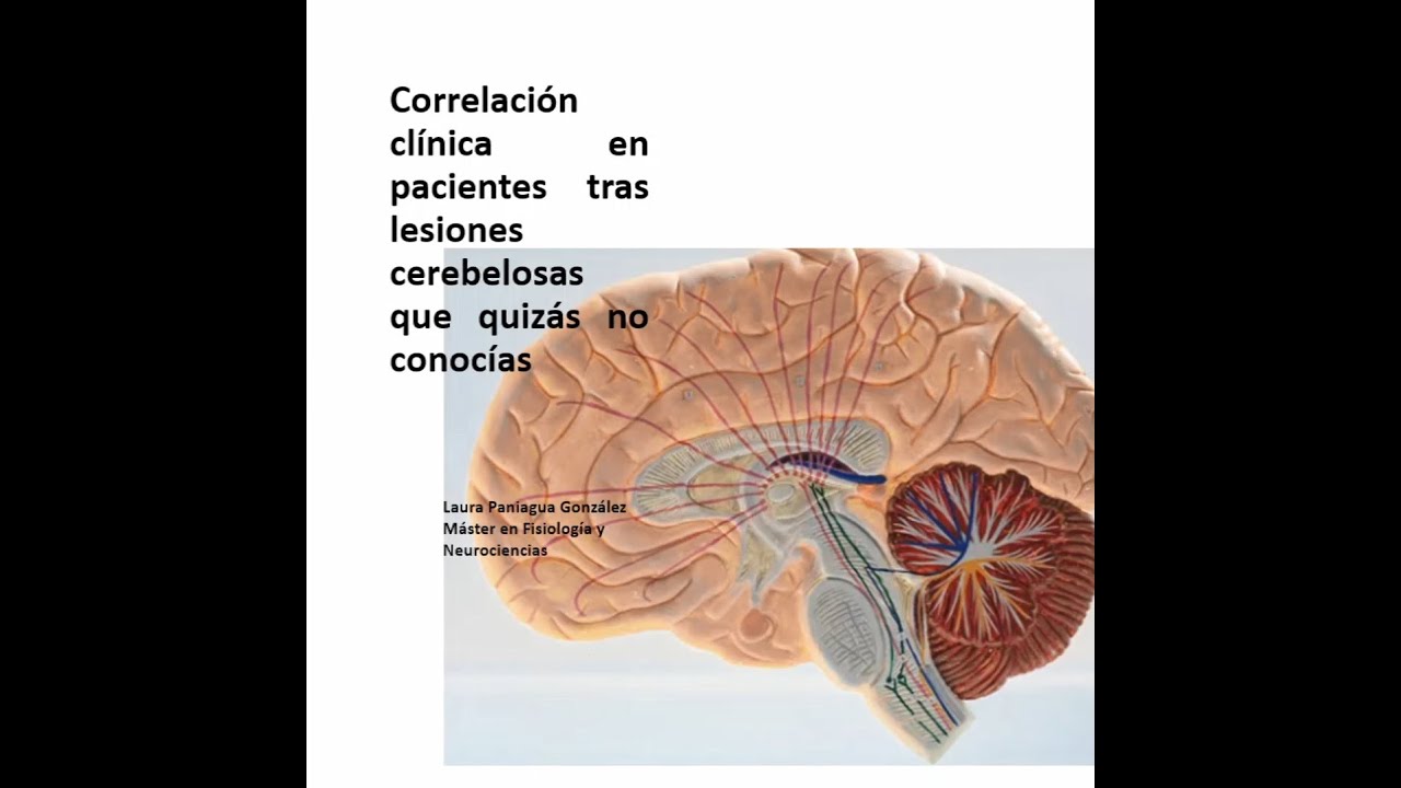 Correlación clínica en pacientes tras lesiones cerebelosas