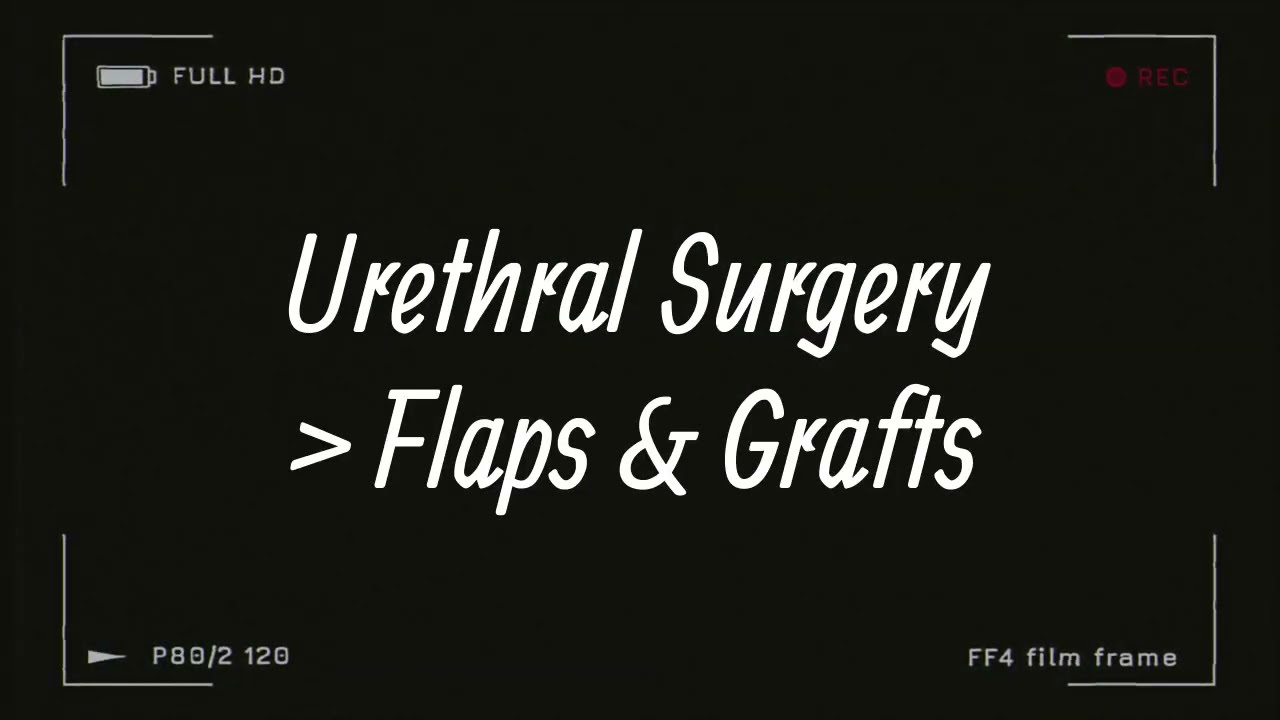 Urethroplasty: Flaps & Grafts