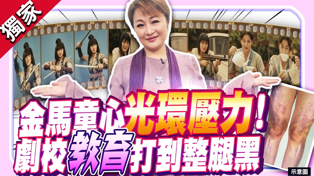 獨家／金馬童星林小樓光環壓力！　劇校遭「特別教育」打到整腿發黑 ⁨@chinatimesent⁩