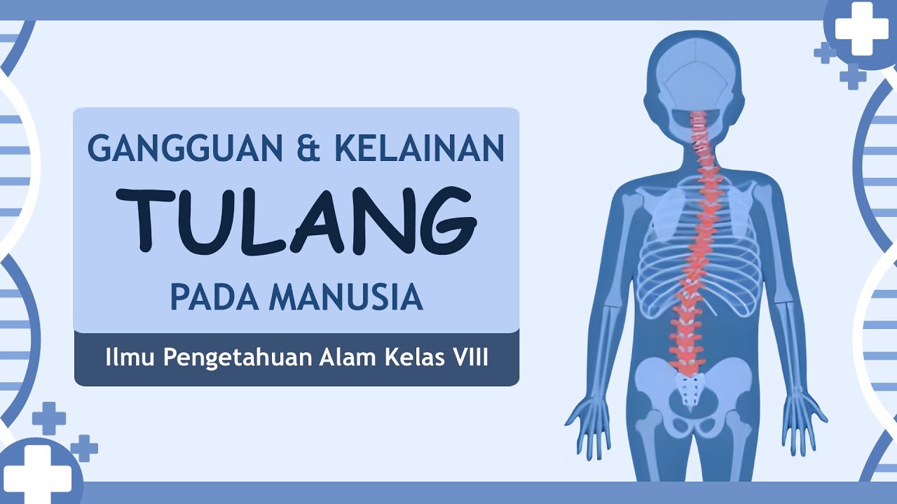 Gangguan & Kelainan Tulang Pada Manusia IPA Kelas 8 (Bio Sains)