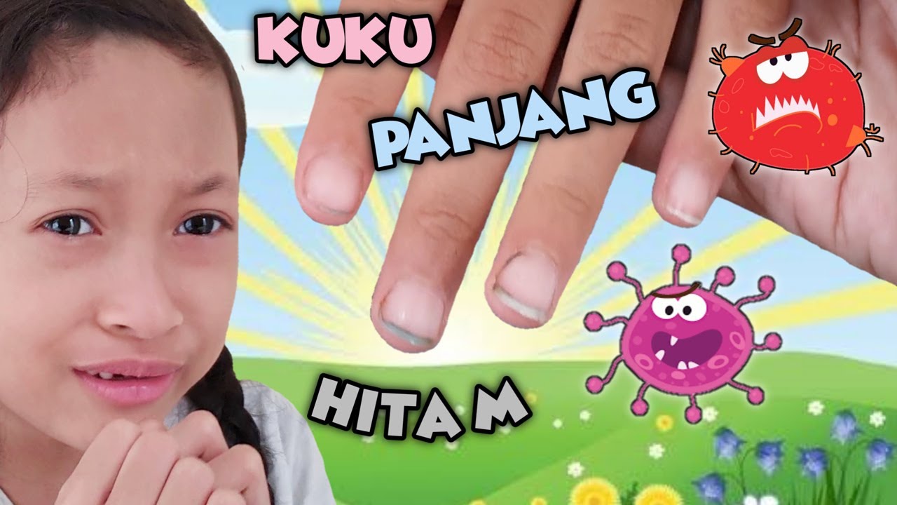 Kuku Panjang dan Hitam 😄 Hiii... Awas Sakit Perut Aqilla - Drama Parodi Aqilla's Diary
