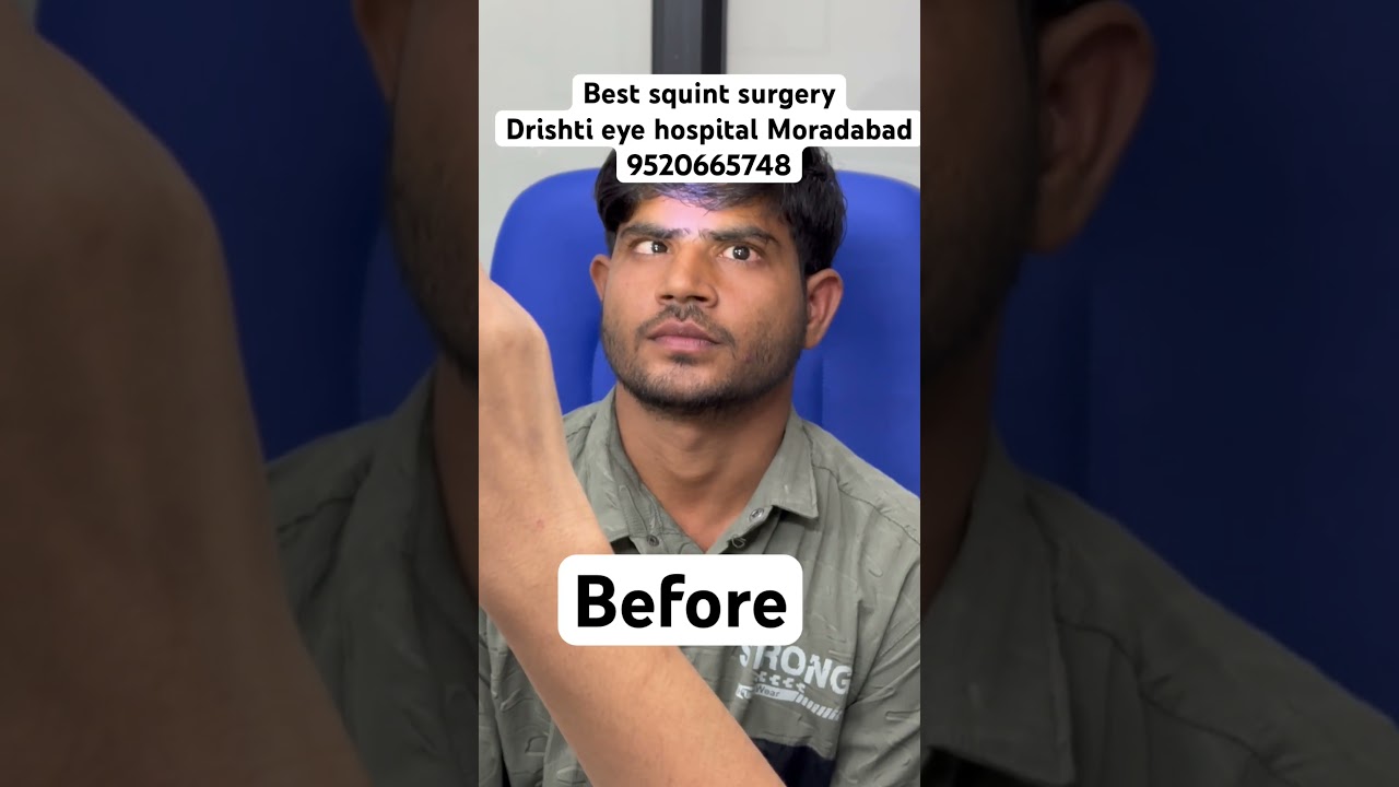 Life changing result | squint surgery | cosmetic surgery | Drishti Eye hospital Moradabad #doctor