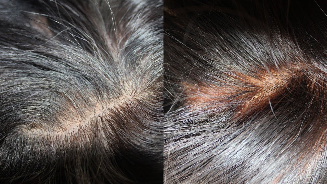 Silk Closure vs Lace Closure