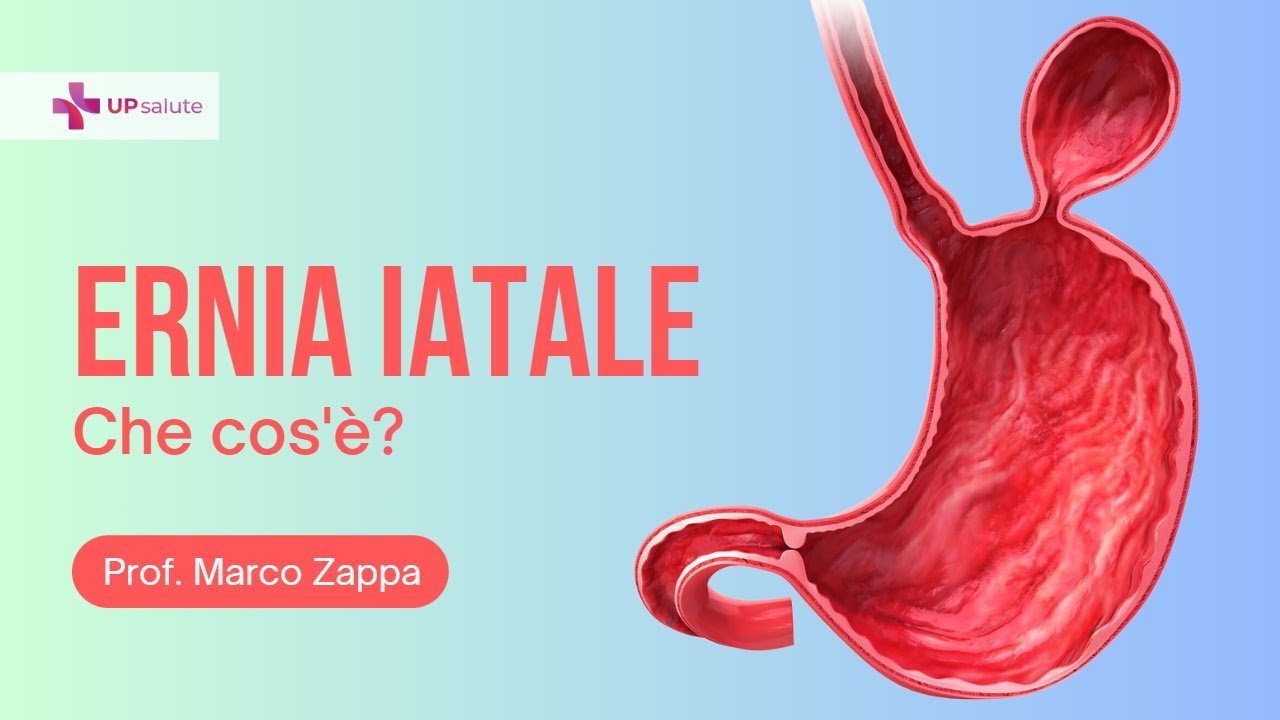 Ernia Iatale  - Prof. Marco Antonio Zappa - UPsalute Channel