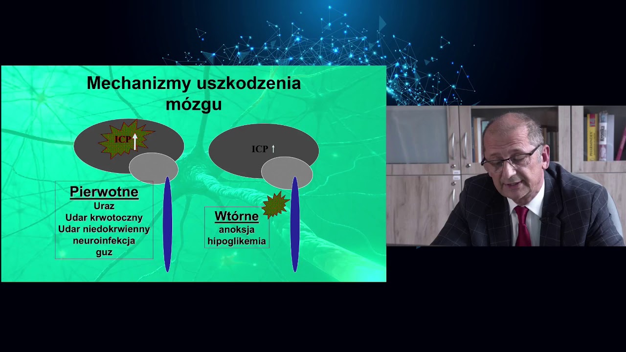 dr hab. Janusz Trzebnicki - śmierć mózgu