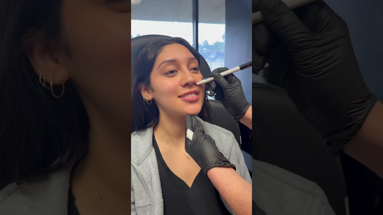 Moxi: The Lunch Time Laser that will give your radiant, healthy skin ✨ #lasertreatment