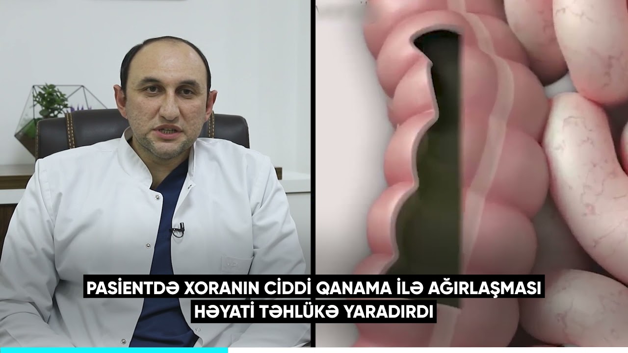 Cərrahiyyə həyat xilas edir.Sağlamlığınızı əmin əllərə etibar edin!