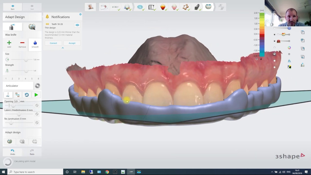 ortho planner, meshmixer, splint studio and implant studio