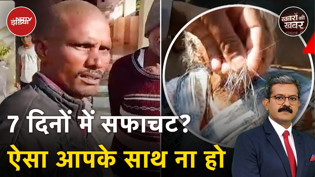 Buldhana Hair Loss: Maharashtra के बुलढाणा में गंजेपन की रहस्यमय बीमारी? | Khabron Ki Khabar