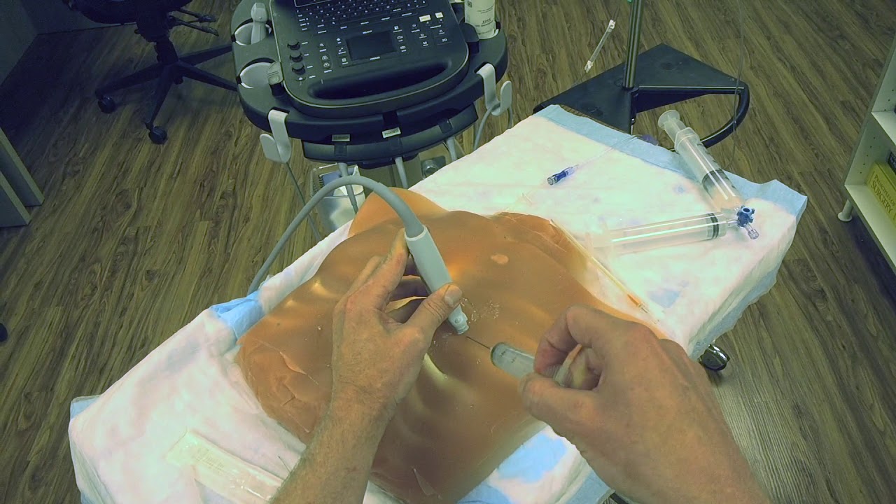Pericardiocentesis POV
