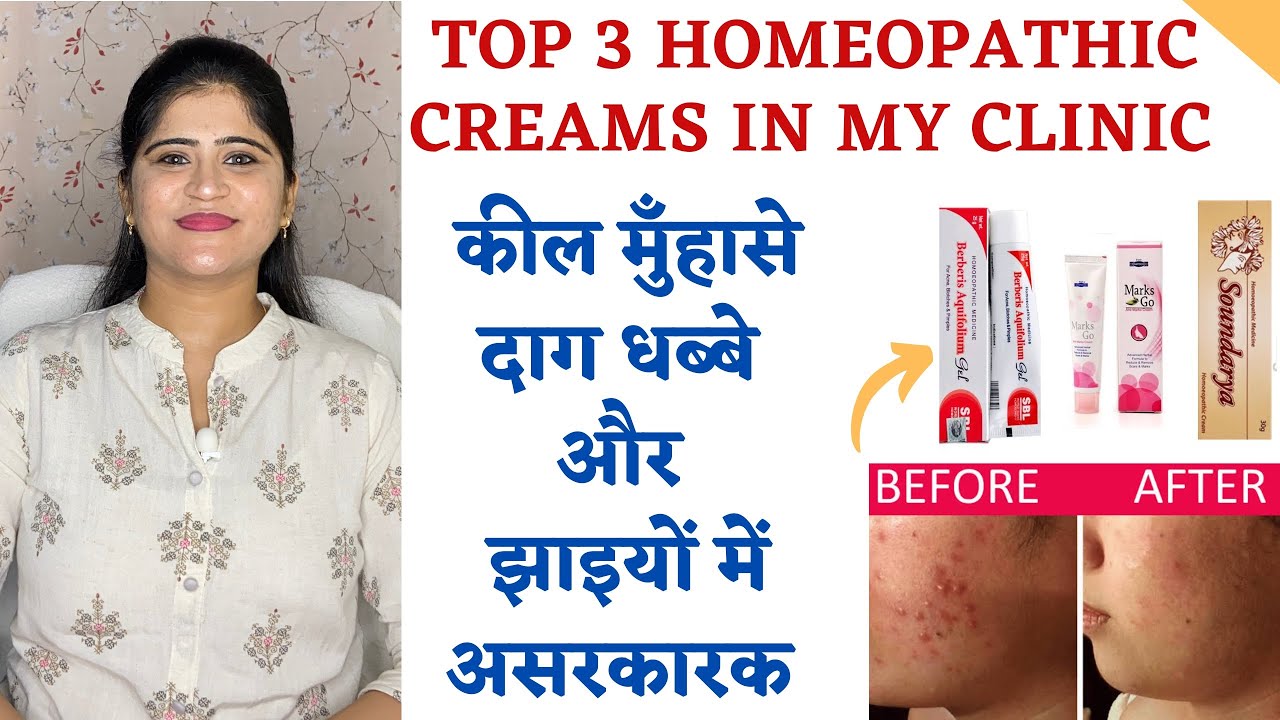 3 Best Homeopathic Creams in my Clinic ॥ कील मुँहासे दाग धब्बे और झाइयों में असरकारक ॥
