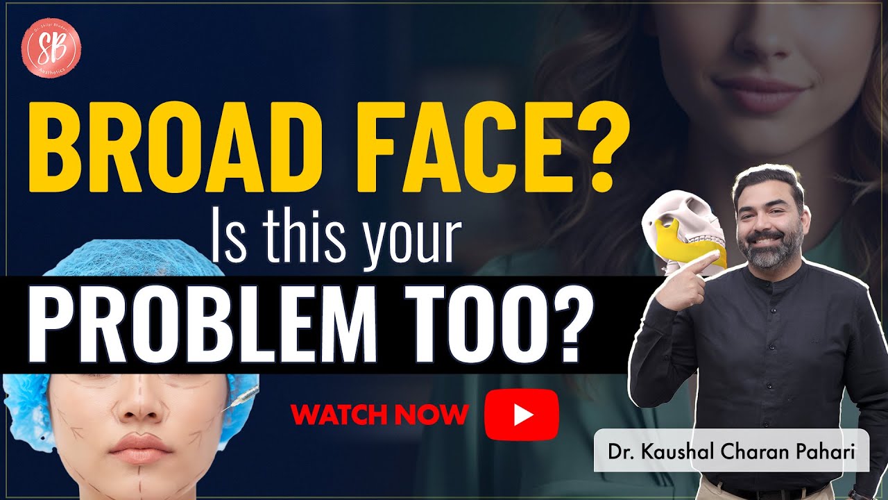 Cheekbone Reduction Surgery | Zygoma Reduction Surgery  | Make You Face Wider | SB Aesthetics