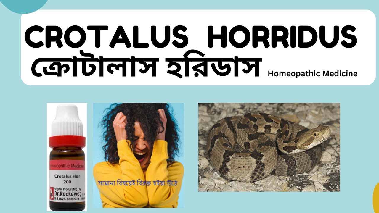 Crotalus Horridus | ক্রোটালাস হরিডাস | Materia Medica | Learn Crotalus Horridus easily