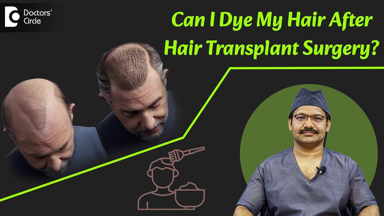 HAIR DYE AFTER HAIR TRANSPLANT | Hair Colouring after FUE, FUT #hairtransplant - Dr.Deepak P Devakar