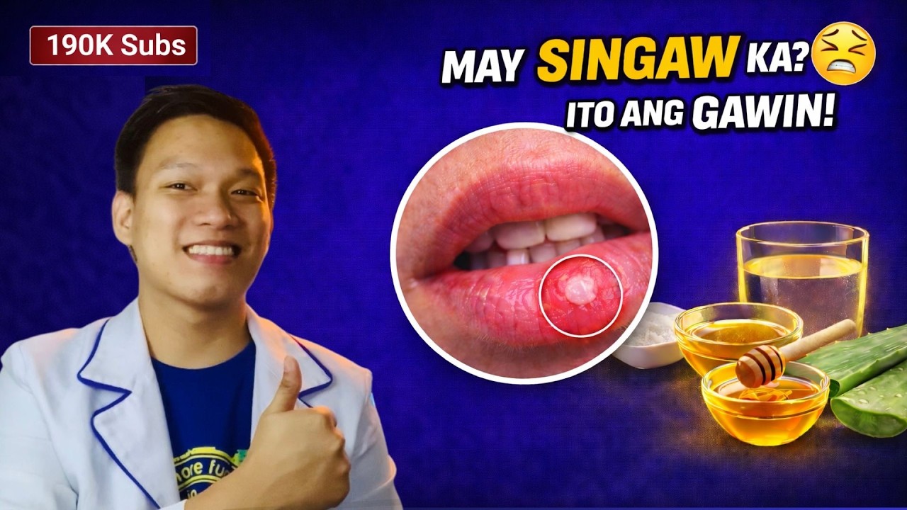 Paano Mawala ang Singaw Mabilis? | Causes + 9 Home Remedies (Tagalog)