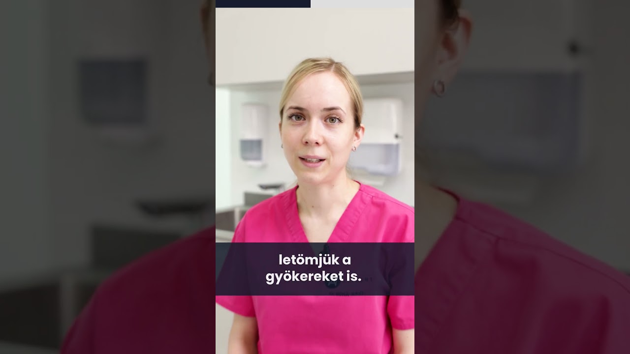 K&uuml;l&ouml;nleges esetek - a fogk&ouml;ztiszt&iacute;t&aacute;s fontoss&aacute;ga 🦷⛓🧹🦷(by B&oacute;na Judit)
