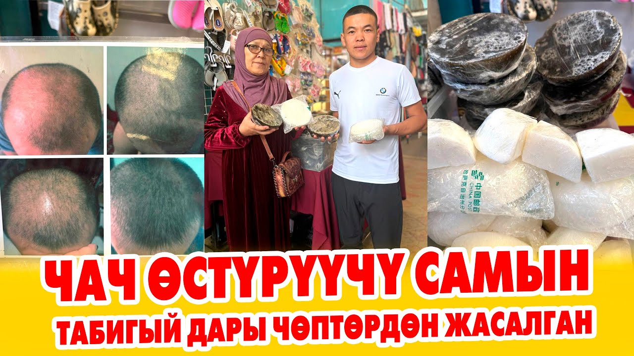 Чачыңыз түшүп какачтап жатса бул көйгөйдү чечүүчү САМЫН бар.