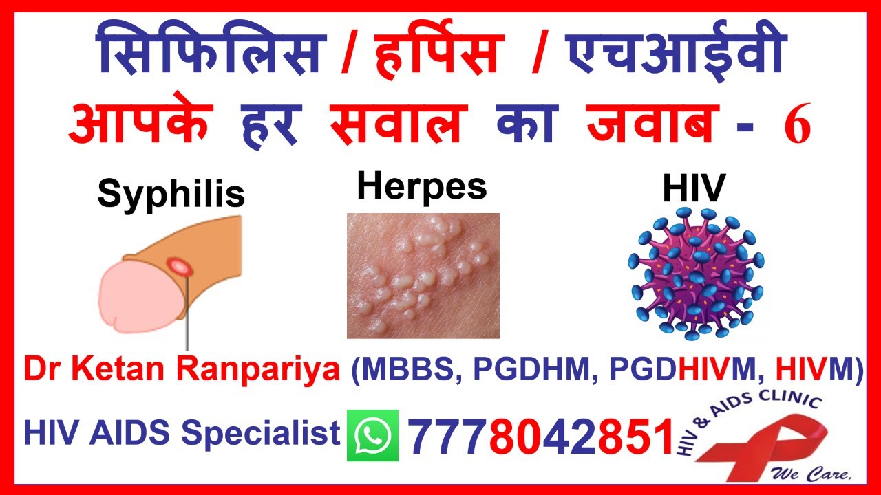hsv 1 and 2 igg positive meaning  | syphilis test | syphilis treatment | hiv test | hiv treatment