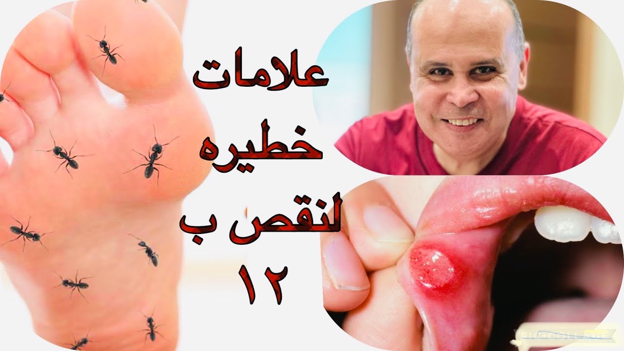 علامات خطيره في جسمك تكشف نقص فيتامين ب١٢ 👌الجلوكوفاج ونقص ب١٢👌التهاب الاعصاب مع مرضي السكر
