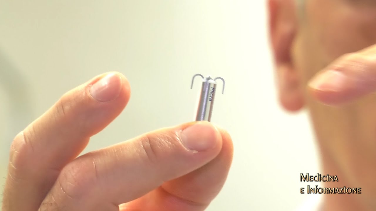 Arriva il Pacemaker del futuro: senza catetere, senza tasca sottocutanea, miniaturizzato