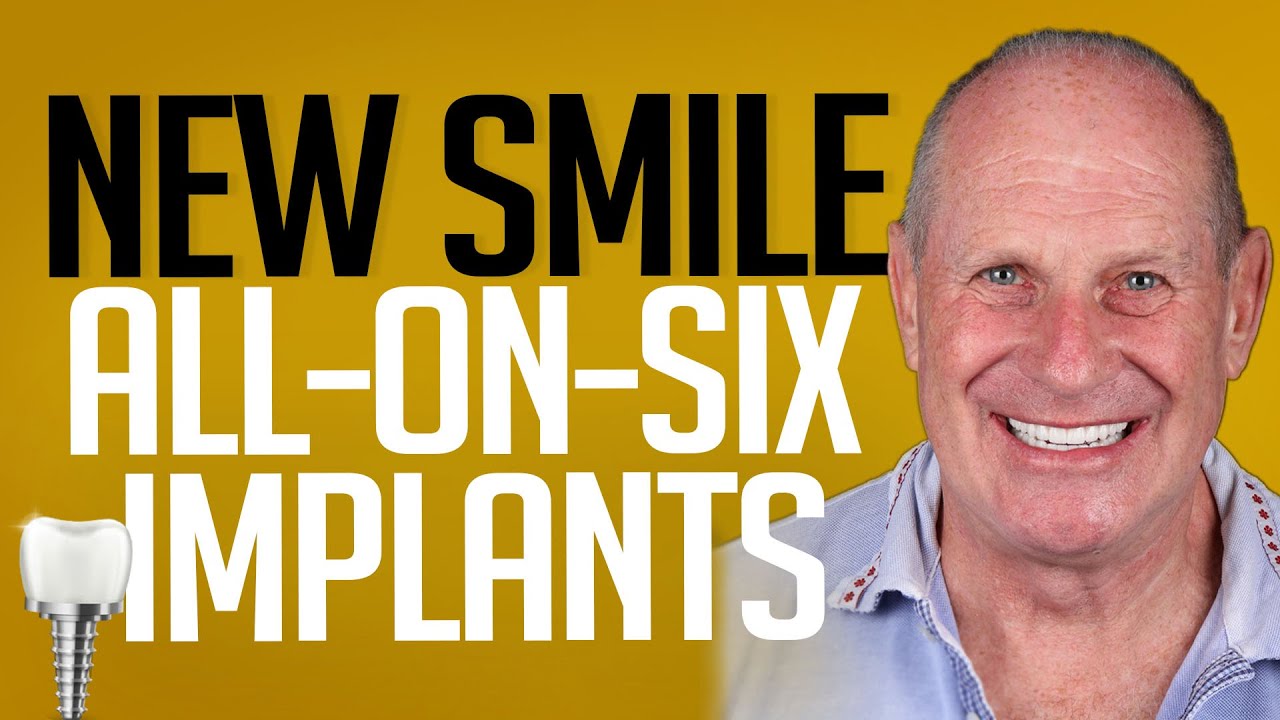 UK Patient’s Smile Restoration in Istanbul | Implants, Crowns & Confidence 💪🏻🇬🇧