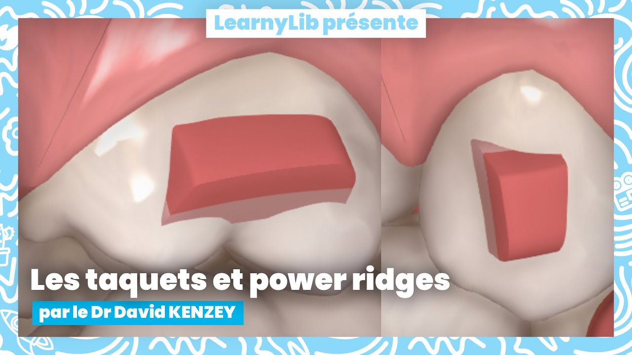 🦷 Les aligneurs en omnipratique : les taquets et power ridges avec le Dr David KENZEY