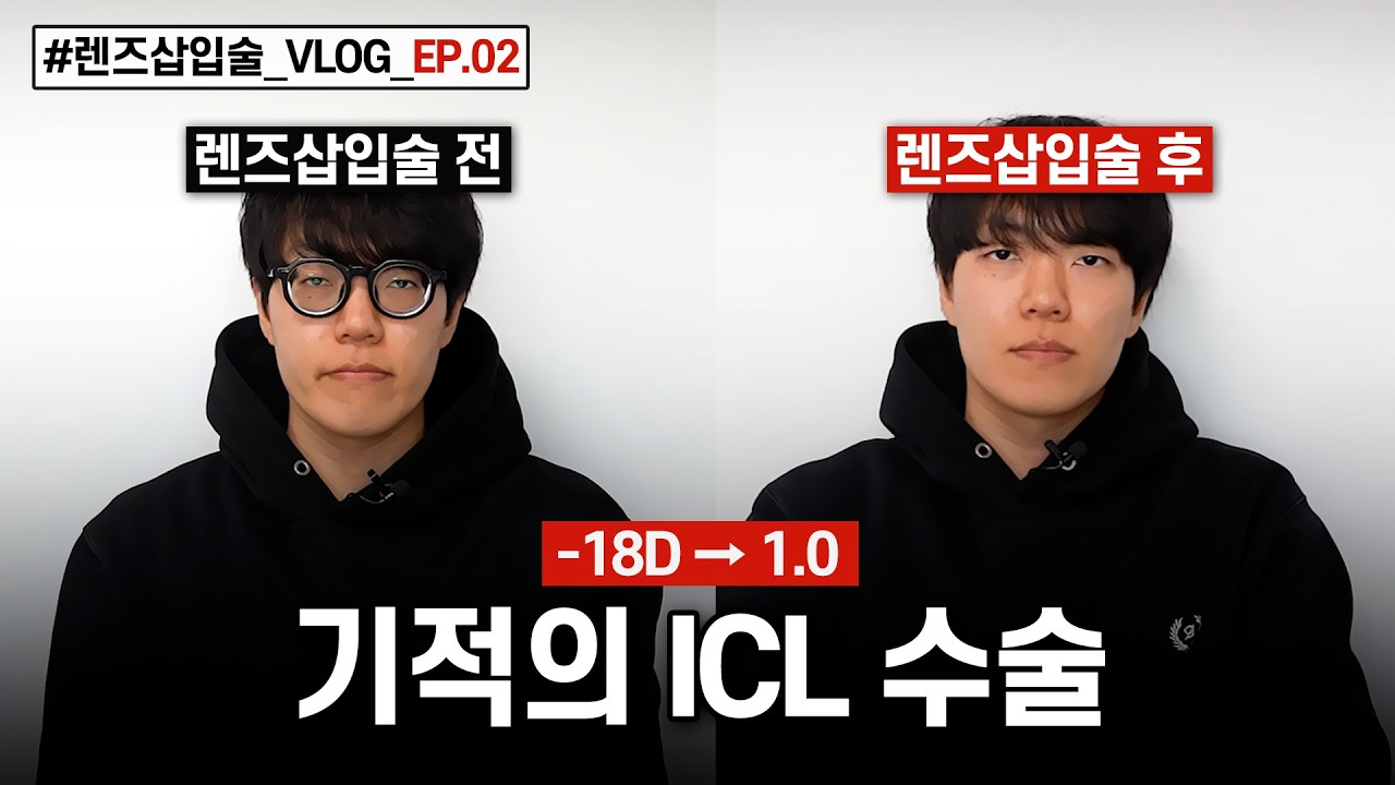 렌즈삽입술 VLOG EP.02_수술 거부 받았었던 안과 직원의 렌즈삽입 수술 여정!