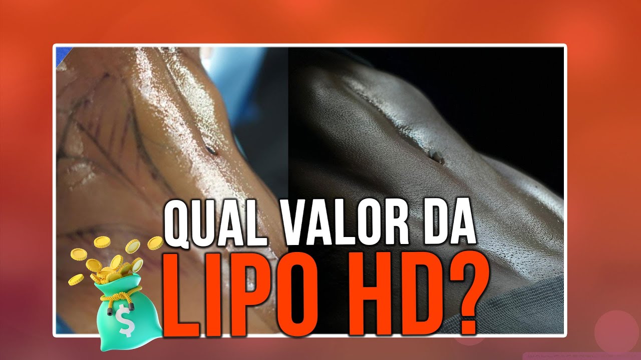 QUAL PREÇO DA LIPO HD - CIRURGIA PLÁSTICA