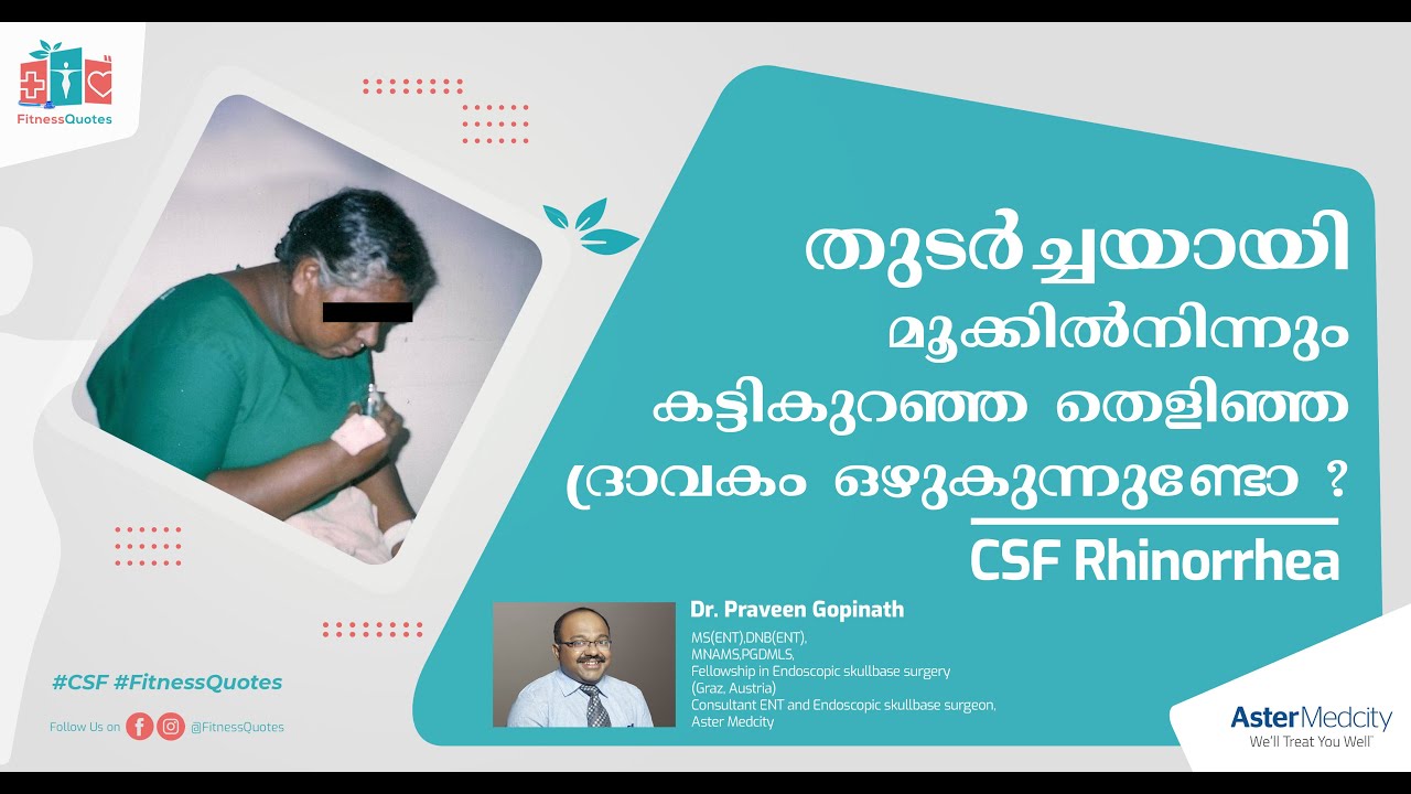 തുടർച്ചയായുള്ള മൂക്കൊലിപ്പ് അവഗണിക്കരുത്  | CSF Rhinorrea Symptoms | CSF Leak | Dr.Praveen Gopinath