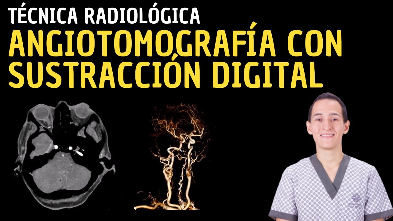 Tutorial Syngo.Via Siemens: Angiografía con sustracción digital en tomografía computarizada.