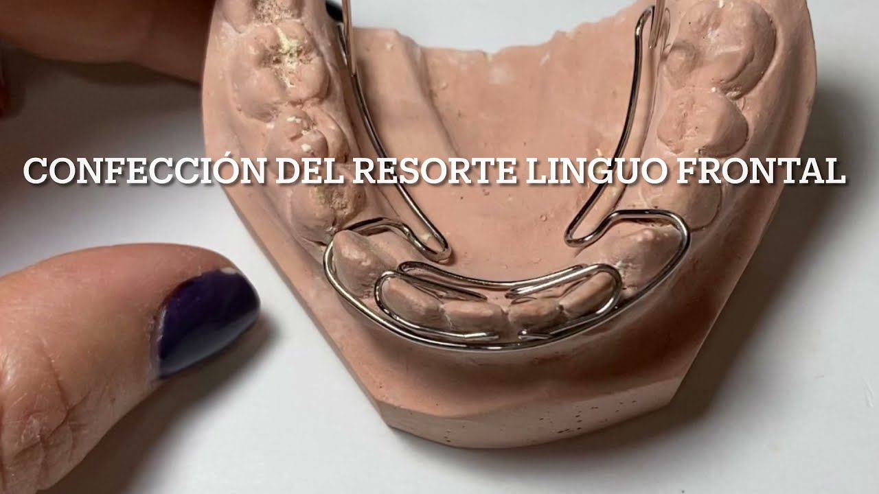 Confección del Resorte Linguo Frontal