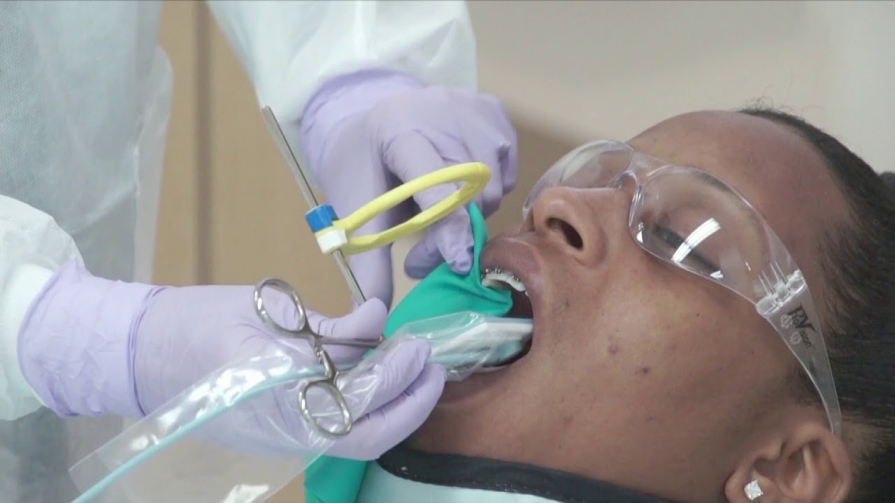 Endo Radio Procedures
