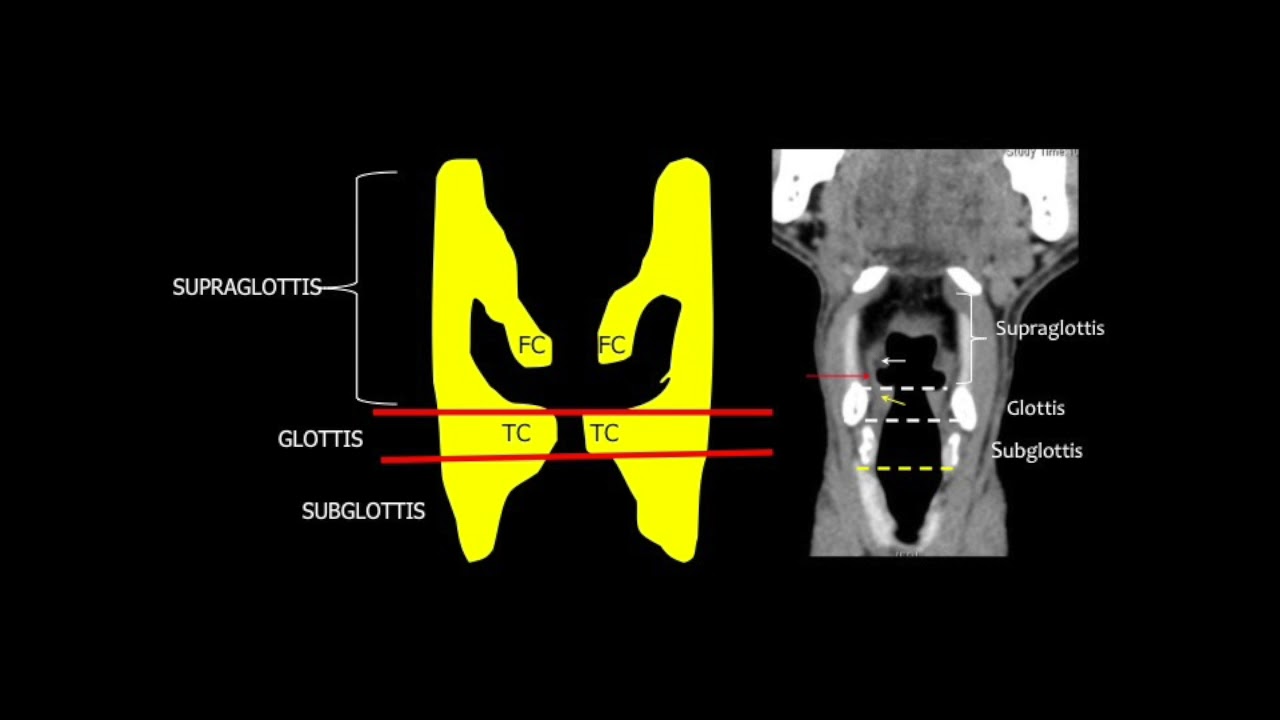TMT: OncoImaging by Dr Abhishek Mahajan