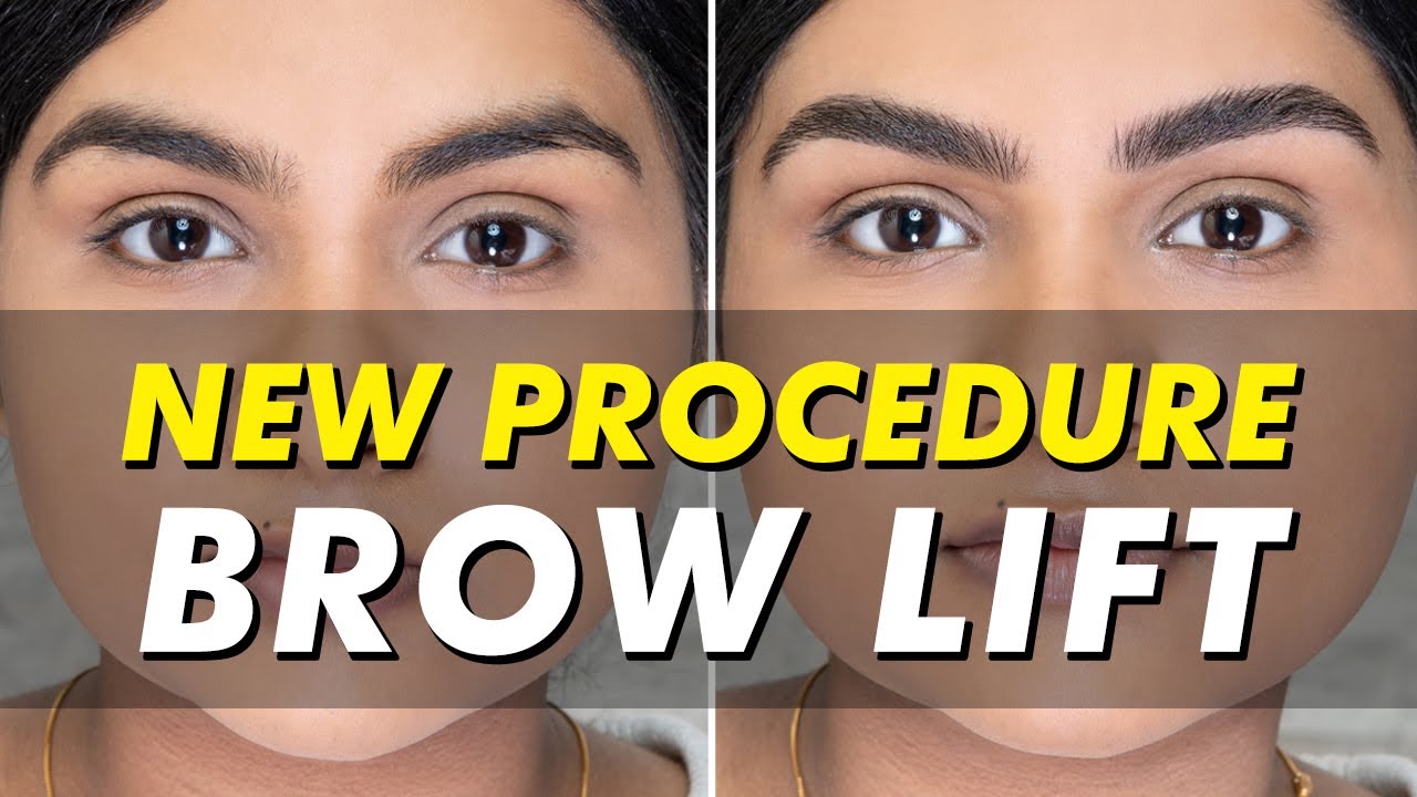 Brow Lift by Nadia Afanaseva | Eye Design New York