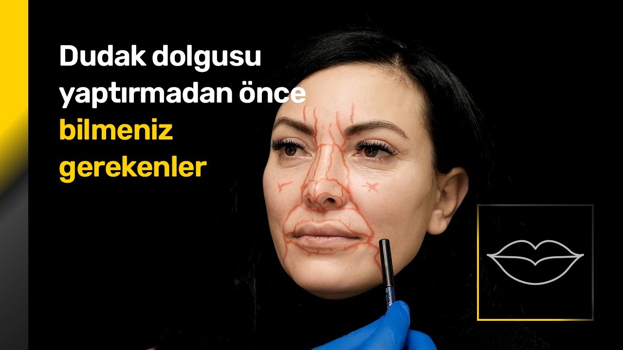 Dudak dolgusu YAPTIRMADAN ÖNCE izleyiniz - Op. Dr. Orhan Murat Özdemir