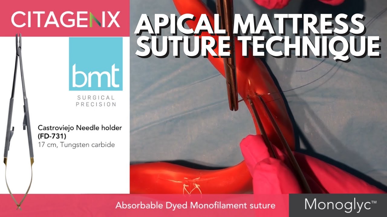 The Apical Mattress Suture Technique Using Monoglyc by Dr. Joseph Choukroun | Citagenix