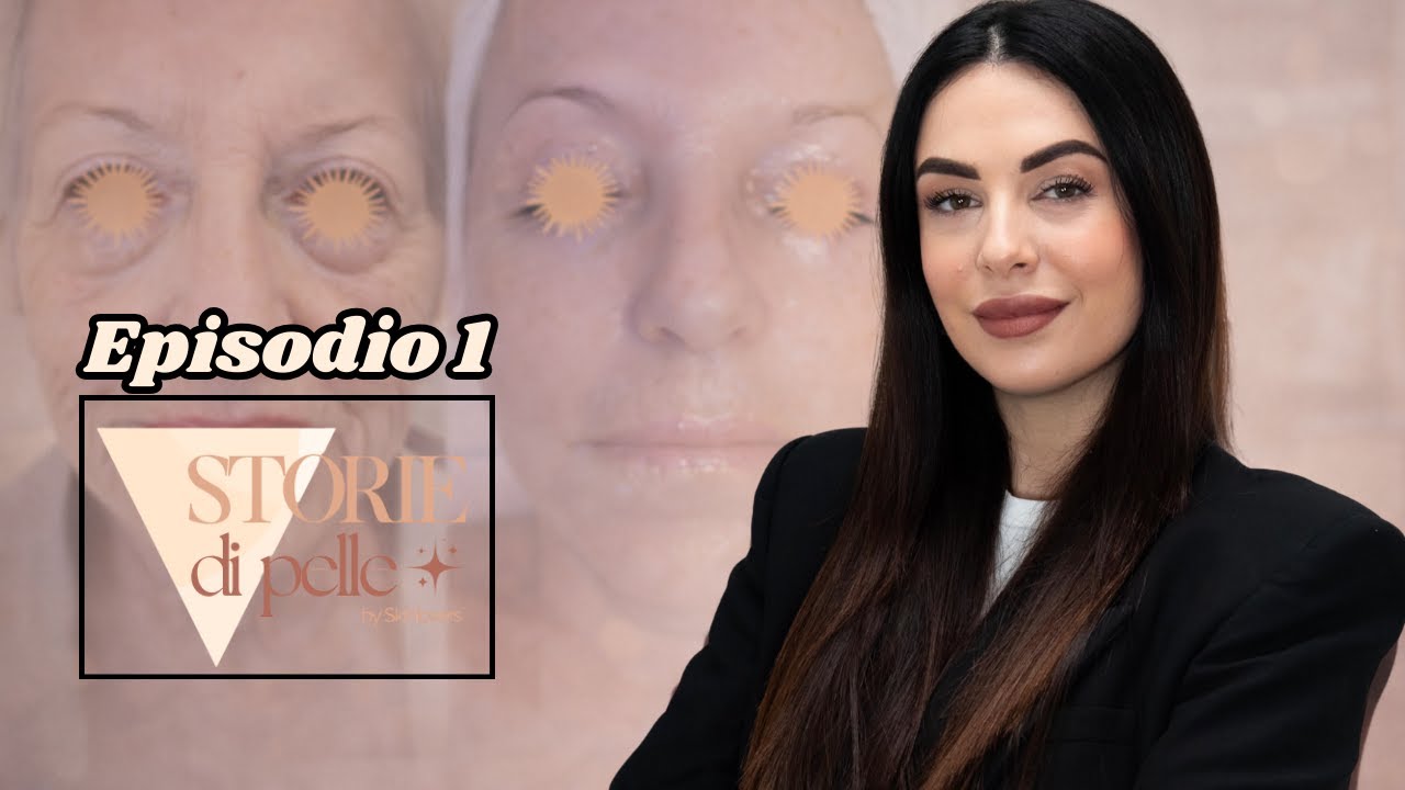 Storie di Pelle Ep.1– L’esperienza di Simona con SkinLovers | Risultati reali in cabina