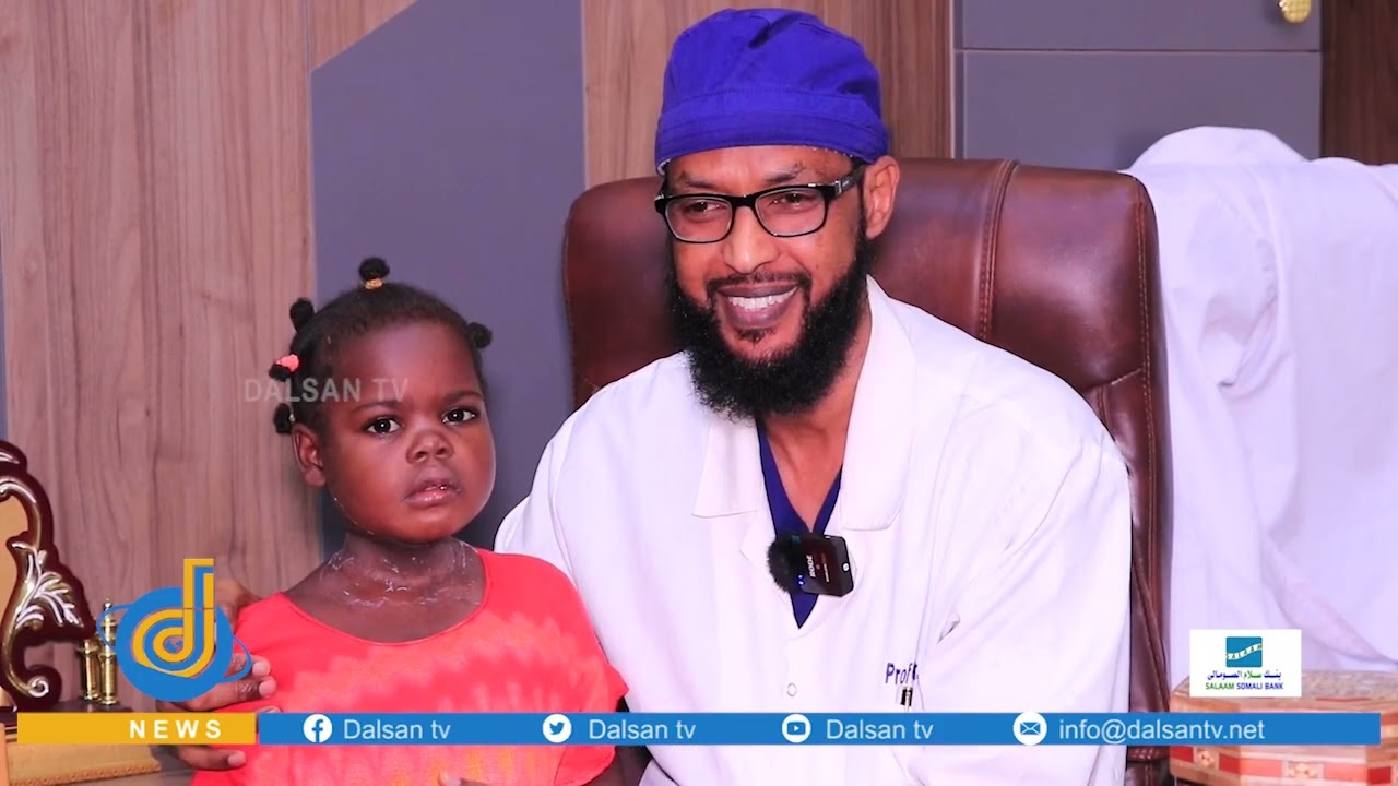 Isbitaalka Shafi oo qaliimo lacag la’aan ah u sameeyay dad danyar ah oo burooyin ay ku yaleen